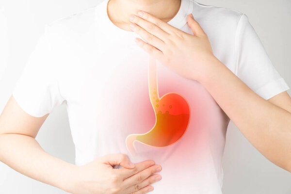Jak léčit gastroezofageální refluxní chorobu doma