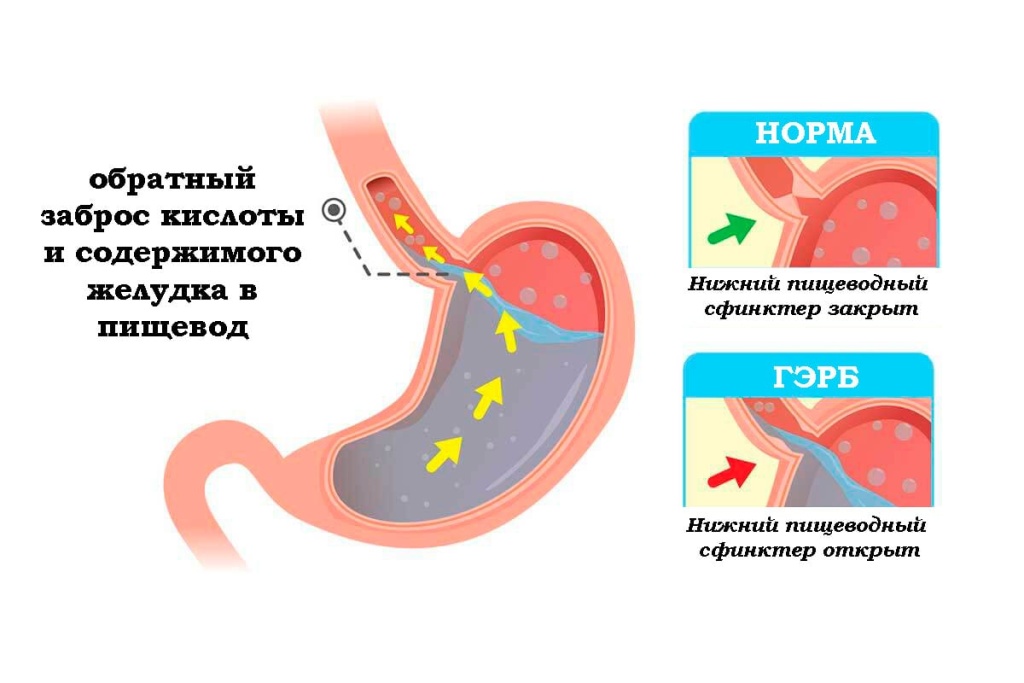 ГЭРБ