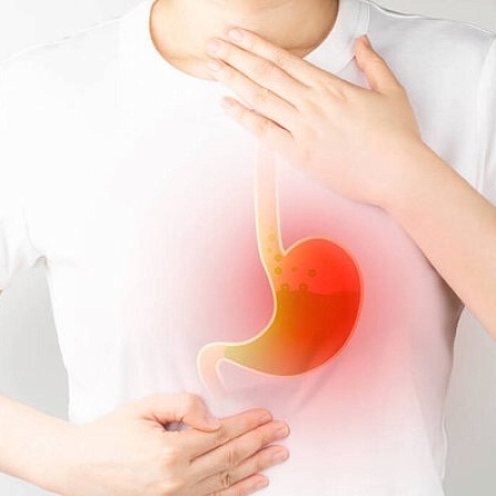 Ako liečiť gastroezofageálnu refluxnú chorobu doma